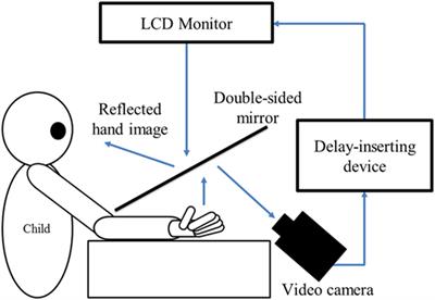 Deficits in Visuo-Motor Temporal Integration Impacts <mark class="highlighted">Manual Dexterity</mark> in Probable Developmental Coordination Disorder